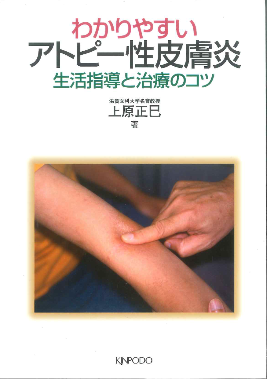 わかりやすいアトピー性皮膚炎 生活指導と治療のコツ 株式会社 金芳堂