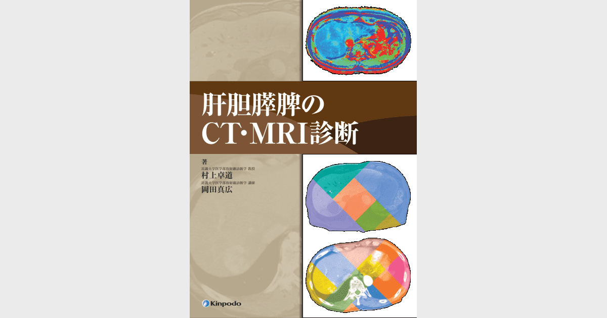 肝胆膵脾のCT・MRI診断 - 株式会社 金芳堂