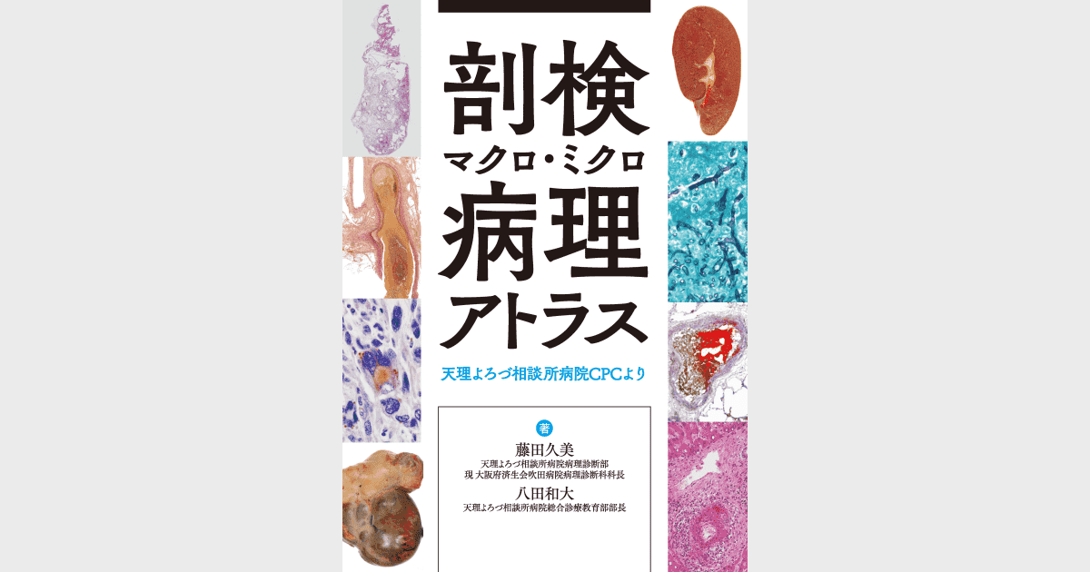 剖検マクロ・ミクロ病理アトラス 天理よろづ相談所病院CPCより - 株式会社 金芳堂