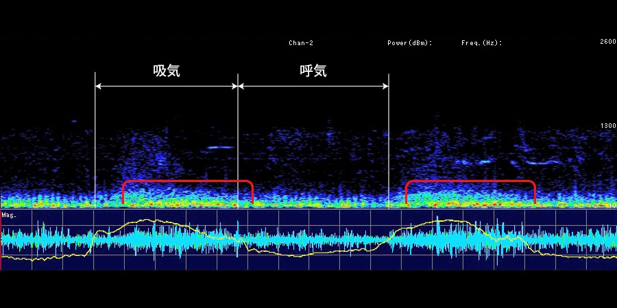 スマホ Pcで聴ける 一番最初に読みたい ナースのための肺の聴診 特設サイト